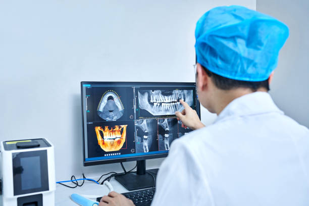 Emergency Dental Filling Replacement in IA